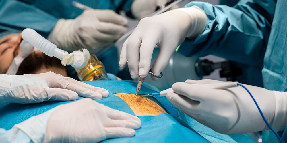 General Laparoscopic Surgery